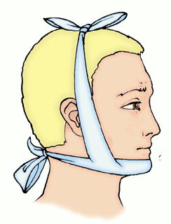 Техника наложения пращевидной повязки. Пращевидная повязка на нос и подбородок. Пращевидная повязка при переломе нижней челюсти. Техника наложения пращевидной повязки на нос и подбородок. Чепец десмургия.