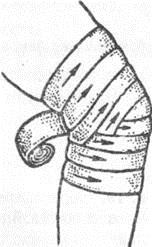 Черепашья сходящаяся на локтевой сустав повязка. Повязка коленный сустав наложить. Черепашья повязка сходящаяся и расходящаяся. Черепашья повязка на коленный сустав. Техника наложения восьмиобразной повязки на коленный сустав.