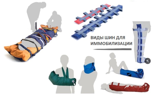 Первая помощь при переломах